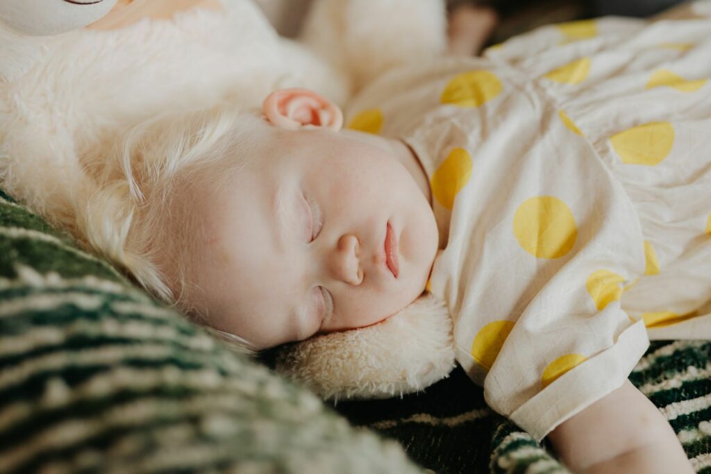 schlafendes Mädchen, mit weißblonden Haaren und einem weißen Kleid mit gelben großen Punkten